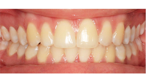 Dentist near Norwood