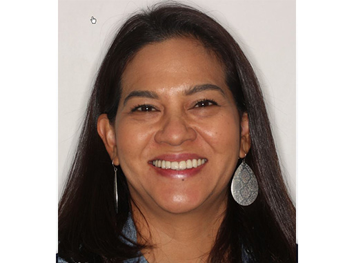 Kids Dentist Norwood