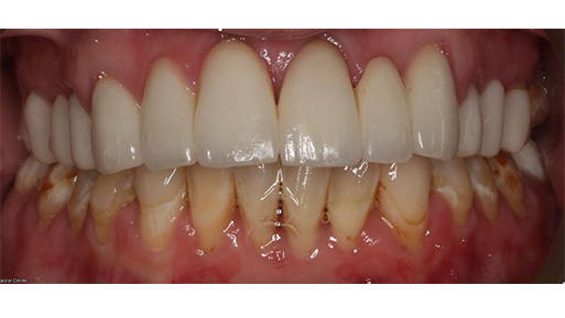 Kids Dentist Norwood