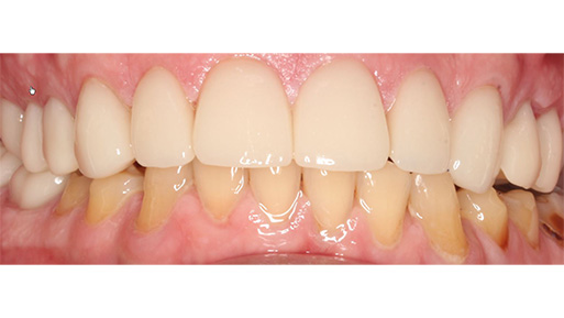 Kids Dentist Norwood