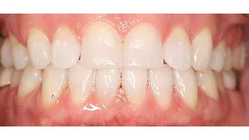 Kids Dentist Norwood