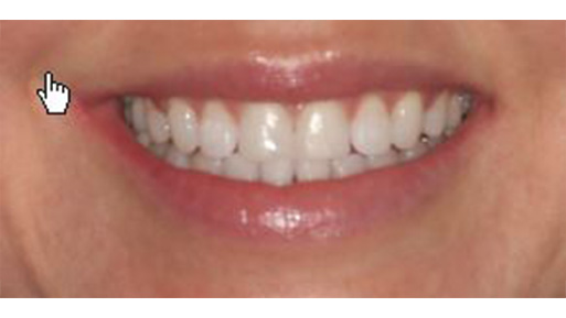 Cosmetic Dentist Inwood