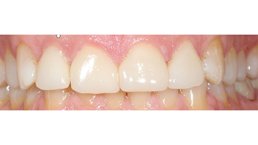 Dentist near Norwood