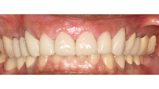 Family Dentist in Manhattan