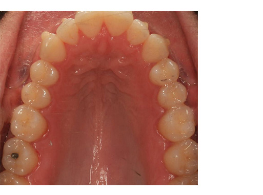 Cosmetic Dentist Inwood