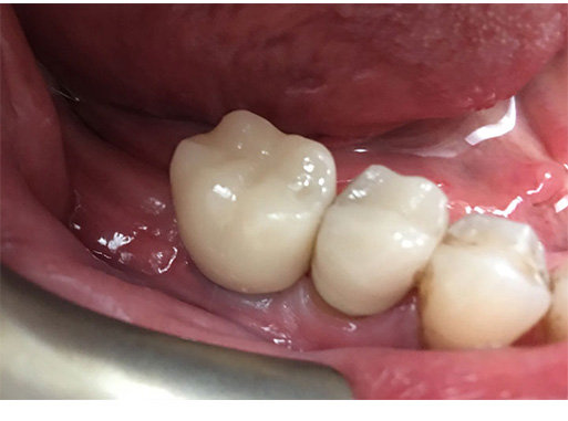 Dentist near Norwood