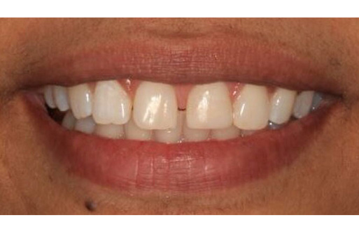 Family Dentist in Manhattan