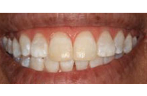 Cosmetic Dental Office in Manhattan