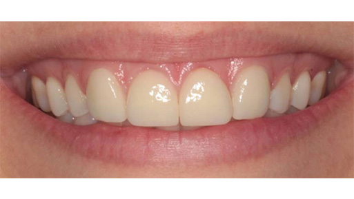 Cosmetic Dentist Inwood