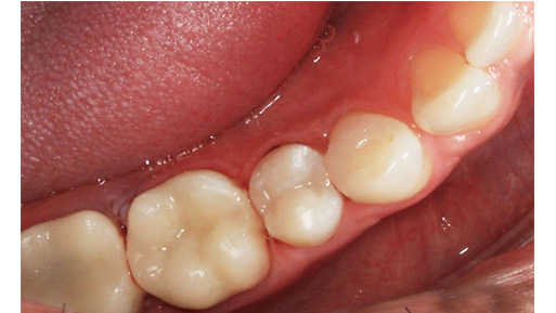 Family Dentist in Manhattan