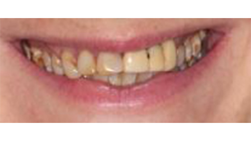 Family Dentist in Manhattan