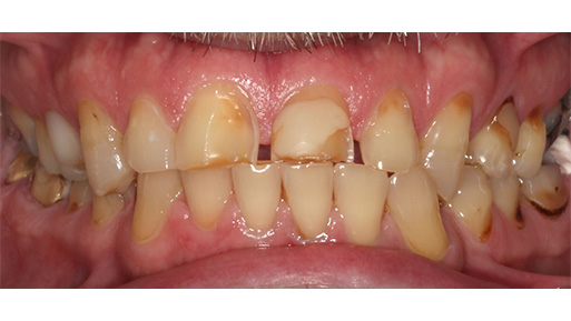 Family Dentist in Manhattan