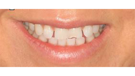 Cosmetic Dental Office in Manhattan