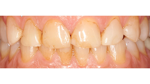 Cosmetic Dental Office in Manhattan