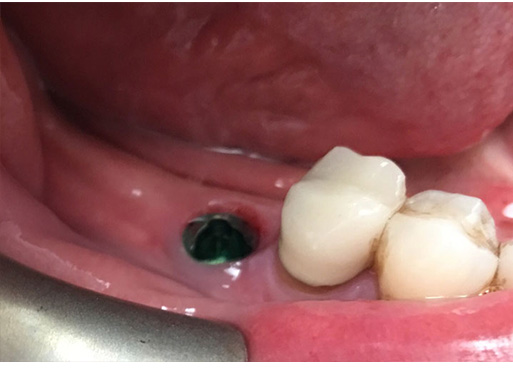 Cosmetic Dentist Inwood