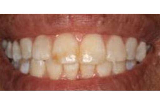 Cosmetic Dental Office in Manhattan