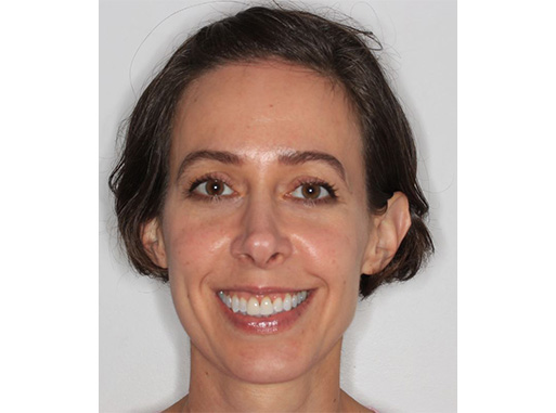 Cosmetic Dentist Inwood